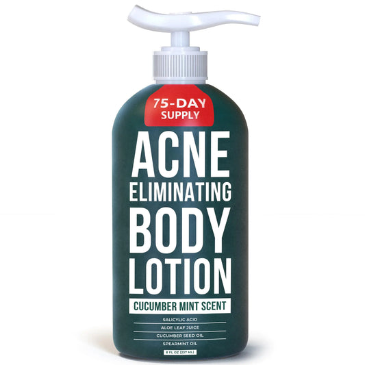 TreeActiv Acne Eliminating Body Lotion 8 fl oz Salicylic Acid Lotion Salicylic Acid Body Acne Treatment Back Acne Treatment Cream for Women and Men Acne Lotion for Body Zit Cream with 2000+ Uses