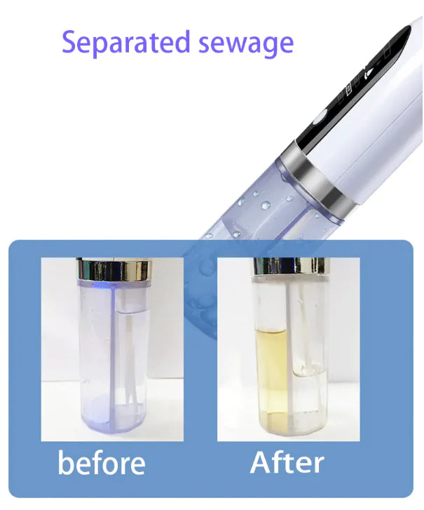 Rechargeable Blackhead Remover Vacuum