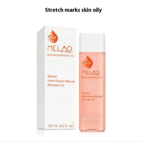 125ml Stretch Mark Moisturizing Lotion